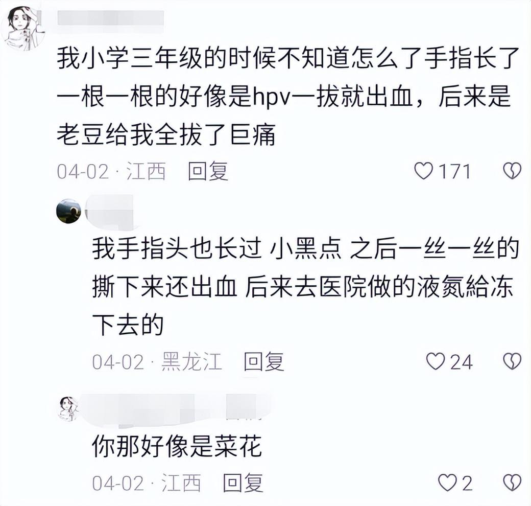 手套健身磨破皮怎么办_运动手套磨损_健身手套磨破