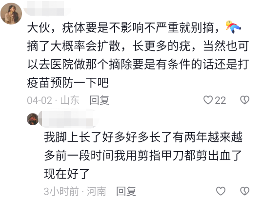 手套健身磨破皮怎么办_运动手套磨损_健身手套磨破