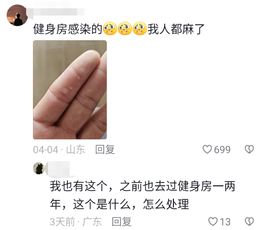 运动手套磨损_健身手套磨破_手套健身磨破皮怎么办