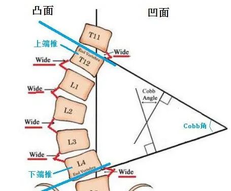 器械胸肌训练_综合训练器 胸肌_胸肌训练器有用吗