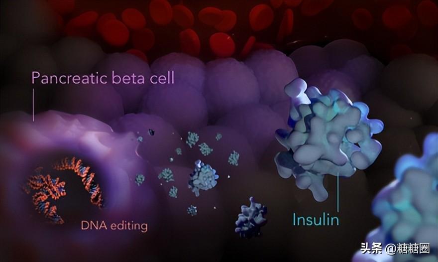 开yun体育官网入口登录app下载 世界首个 1 型糖尿病的基因疗法开展临床试验